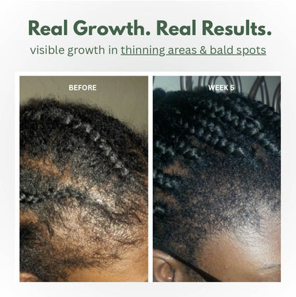 Scalp Stimulator